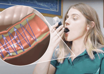 AirPhysio Review